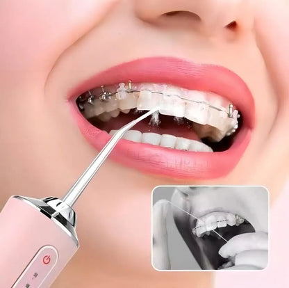 Irrigador Bucal portatil